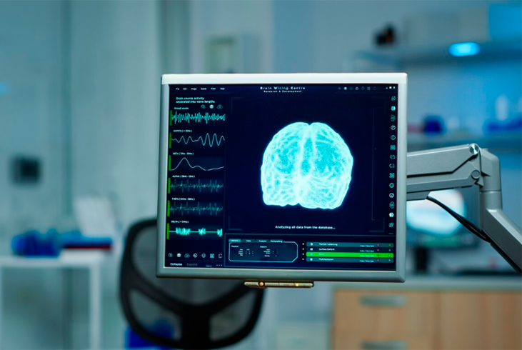 Étude de neuroimagerie IRM sur la perception de la douleur en contexte d’exploration et d’apprentissage